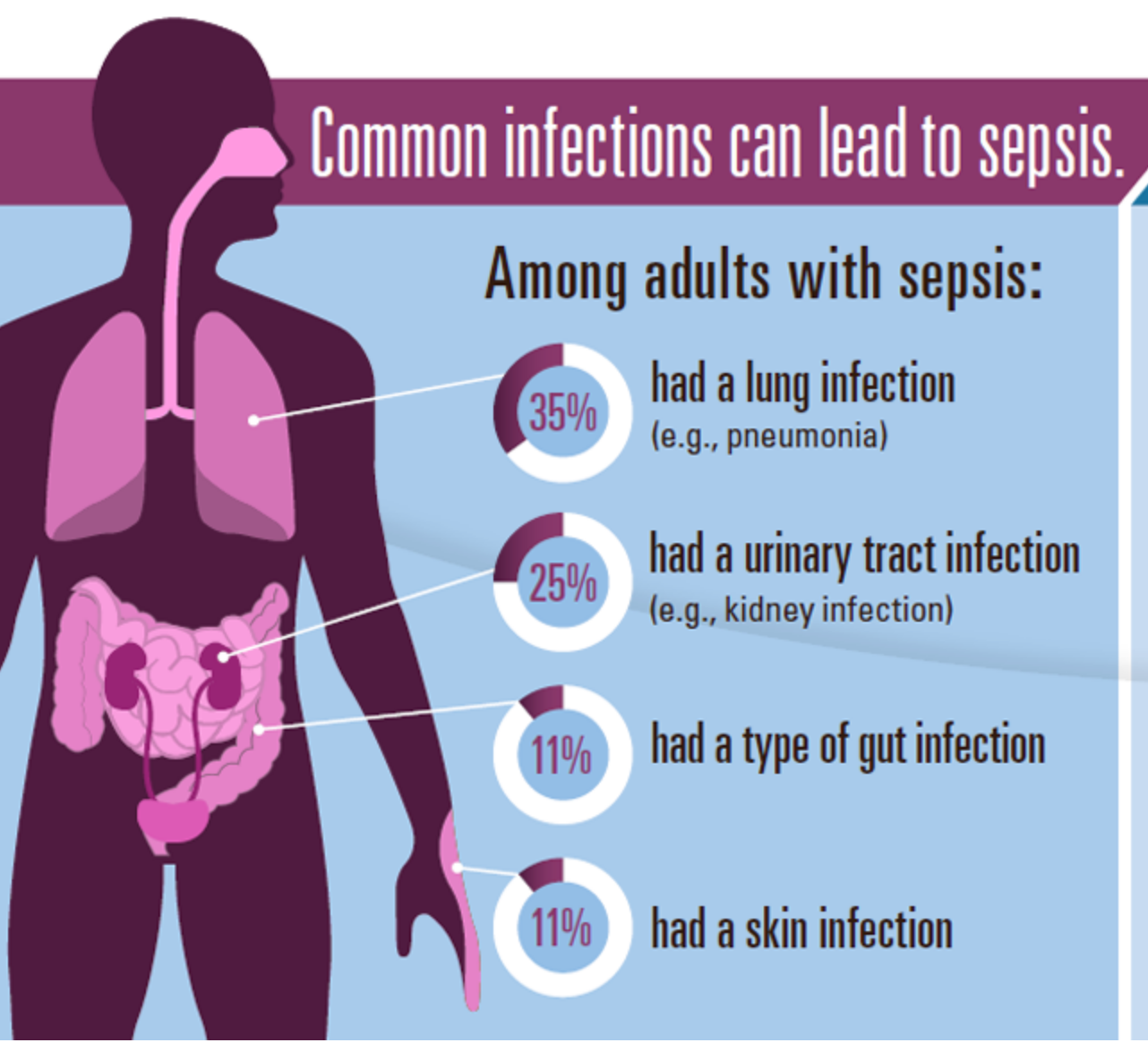 What is septic infection?